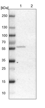 GLYCTK Antibody in Western Blot (WB)