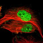 MDC1 Polyclonal Antibody