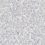 MDC1 Antibody in Immunohistochemistry (Paraffin) (IHC (P))