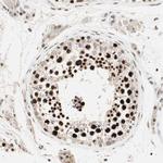 MDC1 Antibody in Immunohistochemistry (Paraffin) (IHC (P))
