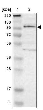 TSHZ1 Antibody in Western Blot (WB)