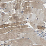 PRDX6 Antibody in Immunohistochemistry (Paraffin) (IHC (P))