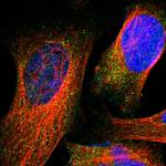 GCK Polyclonal Antibody