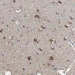 GCK Antibody in Immunohistochemistry (Paraffin) (IHC (P))