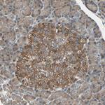 GCK Antibody in Immunohistochemistry (Paraffin) (IHC (P))