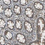 GCK Antibody in Immunohistochemistry (Paraffin) (IHC (P))