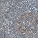 GCK Antibody in Immunohistochemistry (Paraffin) (IHC (P))