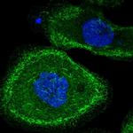 MLK2 Polyclonal Antibody