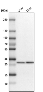 KHK Antibody in Western Blot (WB)