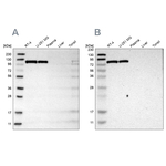 HK1 Antibody in Western Blot (WB)