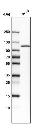HK1 Antibody in Western Blot (WB)