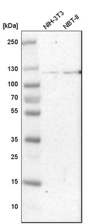 HK1 Antibody in Western Blot (WB)