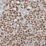 HK1 Antibody in Immunohistochemistry (Paraffin) (IHC (P))