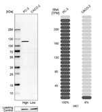 HK1 Antibody in Western Blot (WB)