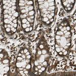 FLII Antibody in Immunohistochemistry (Paraffin) (IHC (P))