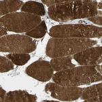 FLII Antibody in Immunohistochemistry (Paraffin) (IHC (P))