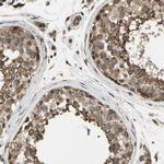 FLII Antibody in Immunohistochemistry (Paraffin) (IHC (P))