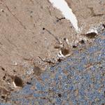 PTPN12 Antibody in Immunohistochemistry (Paraffin) (IHC (P))