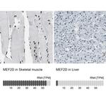 MEF2D Antibody