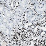 MEF2D Antibody in Immunohistochemistry (Paraffin) (IHC (P))
