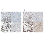 MEF2D Antibody in Immunohistochemistry (Paraffin) (IHC (P))