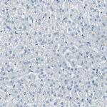 MEF2D Antibody in Immunohistochemistry (Paraffin) (IHC (P))