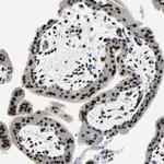 MEF2D Antibody in Immunohistochemistry (Paraffin) (IHC (P))