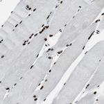 MEF2D Antibody in Immunohistochemistry (Paraffin) (IHC (P))