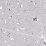 GPR115 Antibody in Immunohistochemistry (Paraffin) (IHC (P))