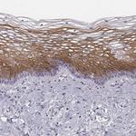 GPR115 Antibody in Immunohistochemistry (Paraffin) (IHC (P))