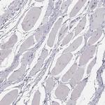 GPR115 Antibody in Immunohistochemistry (Paraffin) (IHC (P))