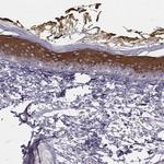 GPR115 Antibody in Immunohistochemistry (Paraffin) (IHC (P))