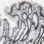 FOXP4 Antibody in Immunohistochemistry (Paraffin) (IHC (P))