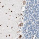 P4HTM Antibody in Immunohistochemistry (Paraffin) (IHC (P))