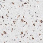 P4HTM Antibody in Immunohistochemistry (Paraffin) (IHC (P))