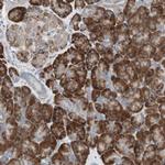 P4HTM Antibody in Immunohistochemistry (Paraffin) (IHC (P))