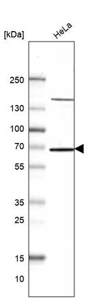P4HTM Antibody in Western Blot (WB)
