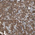 MPI Polyclonal Antibody
