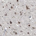 ACAA1 Antibody in Immunohistochemistry (Paraffin) (IHC (P))