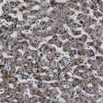ACAA1 Antibody in Immunohistochemistry (Paraffin) (IHC (P))