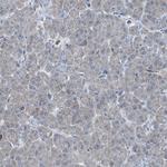 ACAA1 Antibody in Immunohistochemistry (Paraffin) (IHC (P))