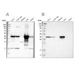 ACAA1 Antibody in Western Blot (WB)