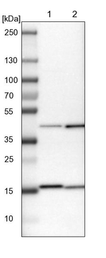 ACAA1 Antibody in Western Blot (WB)