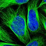 ZNF165 Polyclonal Antibody