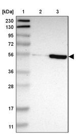 ZNF165 Antibody in Western Blot (WB)