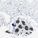 Cytokeratin 7 Antibody in Immunohistochemistry (Paraffin) (IHC (P))