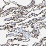 Cytokeratin 7 Antibody in Immunohistochemistry (Paraffin) (IHC (P))
