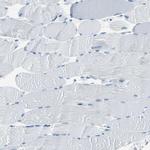 Cytokeratin 7 Antibody in Immunohistochemistry (Paraffin) (IHC (P))