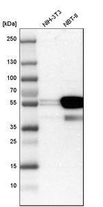 Cytokeratin 7 Antibody in Western Blot (WB)