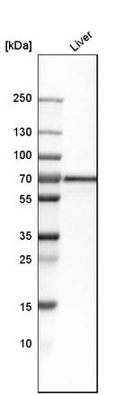 SLC27A5 Antibody in Western Blot (WB)